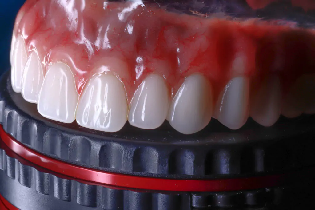 Modelo de prótese dentária